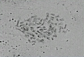 Pentaploid Mulga